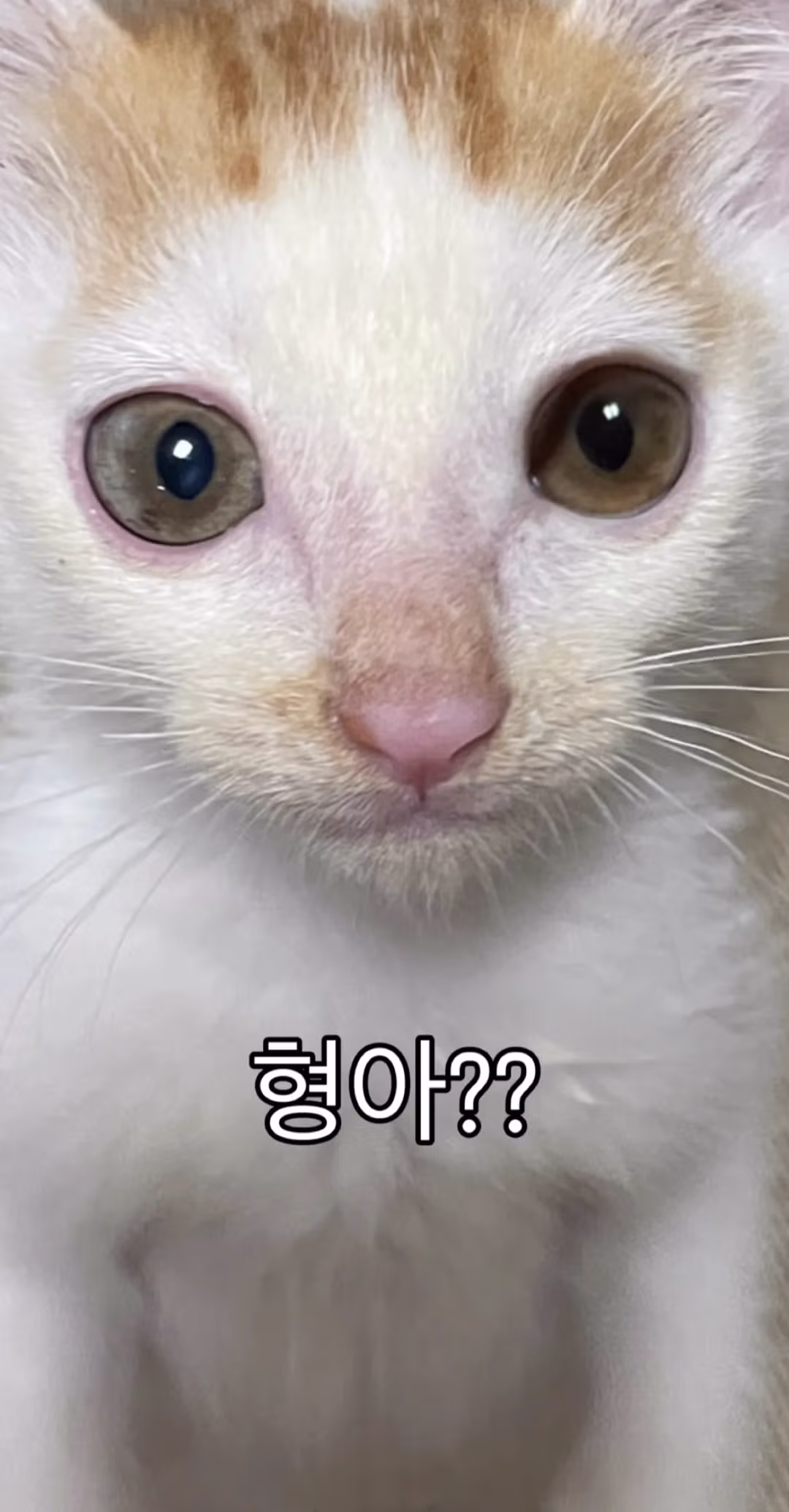 "형아! 나 드디어 눈 기증 받게 됐대!" 7