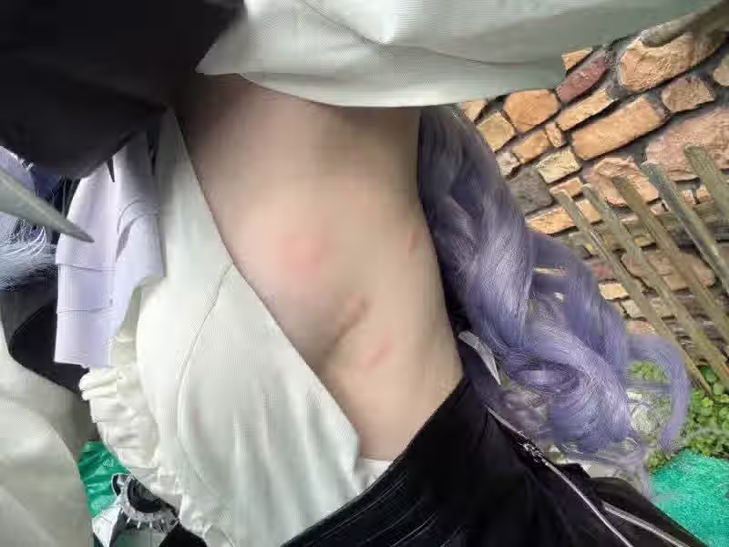 ㅇㅎ?) 노출 많은 코스프레의 단점.jpg 2