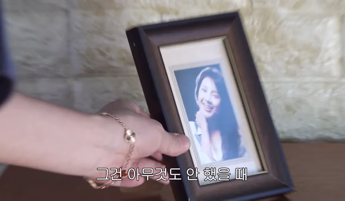 서인영 코(끝)성형 5번 하기 전81 14