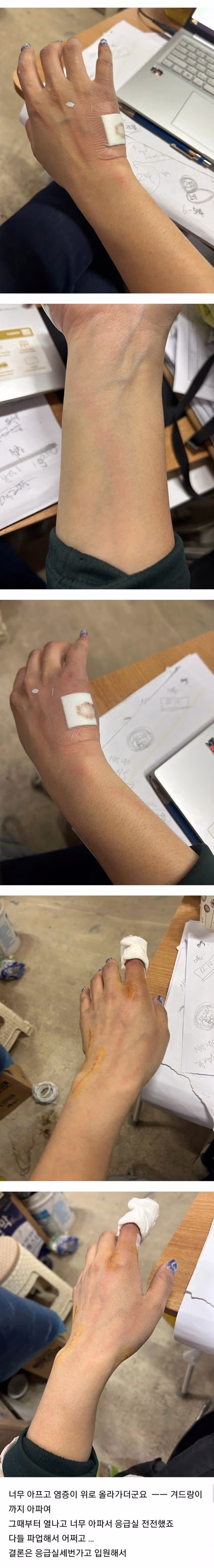 (혐) 고양이에게 물린 캣맘 4