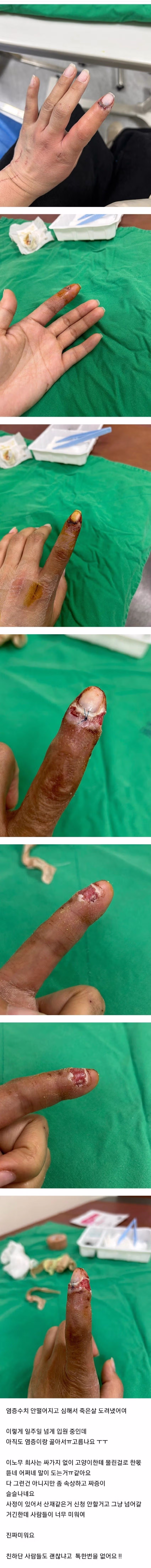 (혐) 고양이에게 물린 캣맘 5