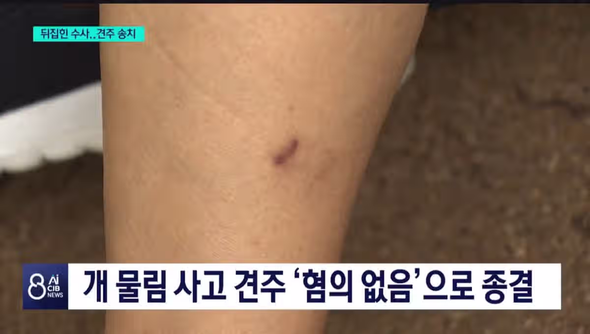 청주 개물림 무혐의... 취재가 시작되자 송치.jpg 2