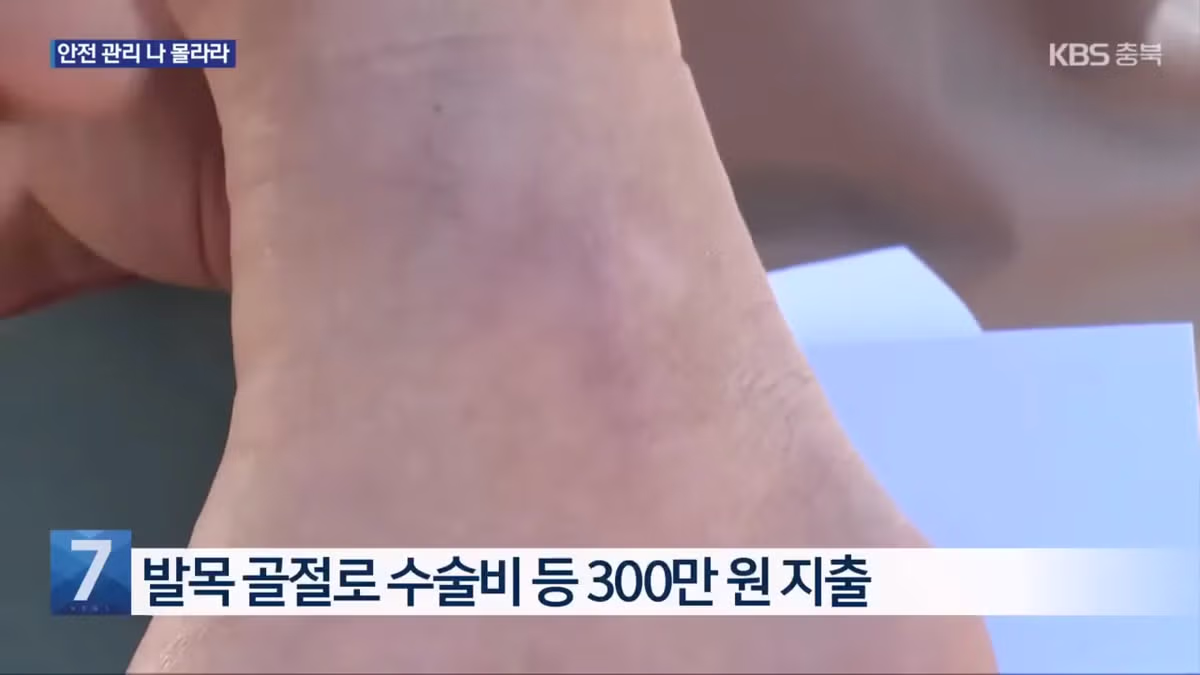 인도 걷다가 다친 시민에 소송 건 청주시... 결국 '패소' 3