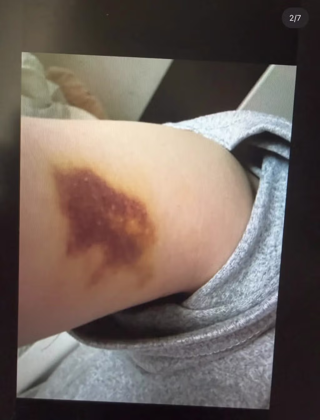 지수 친오빠 부인 가정폭력 폭로중 11