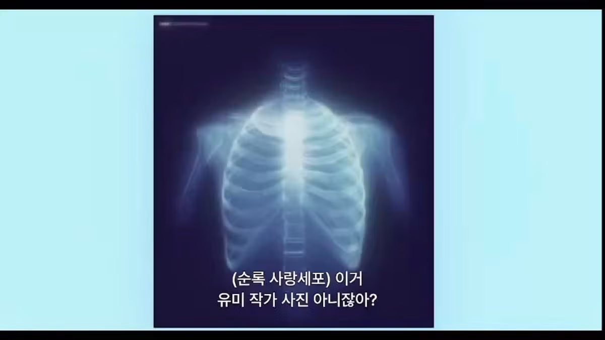 <유미의 세포들3> 신박하게 잘썼다는 반응 많은 순록 사랑세포 외과의사.jpg - 밈카세