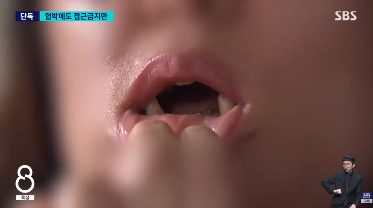 [단독] 이직 4번 했는데 계속 따라와…'극심한 스트레스' 아랫니까지 '푹' 13