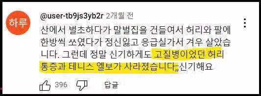 말벌에 쏘인 후기 4