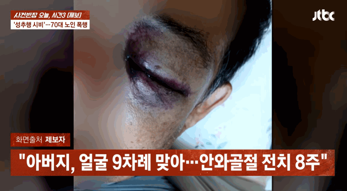성추행 의심 받고...폭행 당한 뇌경색 앓는 70대 노인 - 밈카세