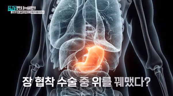 본인 동의 없이 위 축소술 받았다는 신해철.jpg - 밈카세