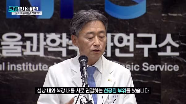 본인 동의 없이 위 축소술 받았다는 신해철.jpg - 밈카세