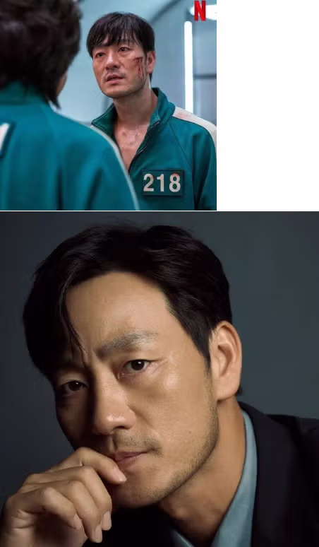 모발 이식후 초대박난 배우 - 더쿠 인기글 이미지 4 - 밈카세