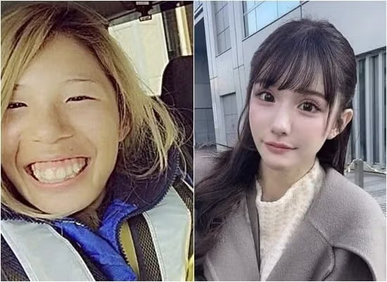 2억원치 성형결과 - 개드립 인기글 이미지 2 - 밈카세