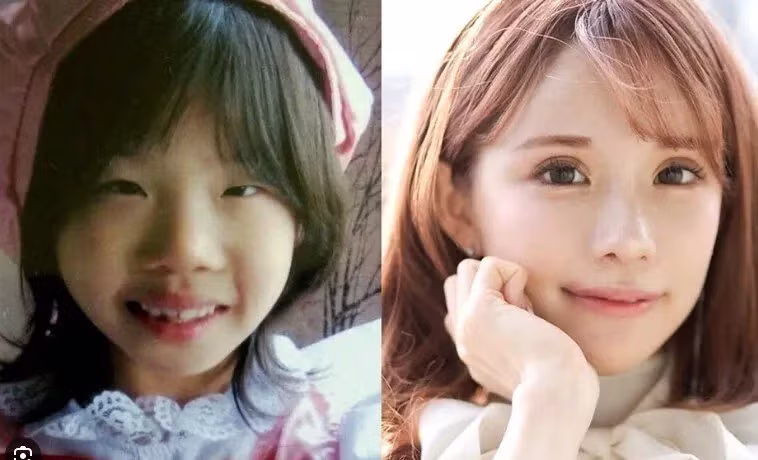 2억원치 성형결과 - 개드립 인기글 이미지 3 - 밈카세
