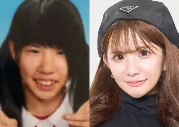 2억원치 성형결과 - 개드립 인기글 이미지 4 - 밈카세