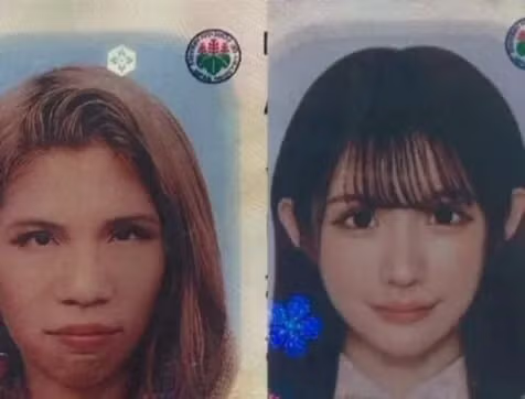 2억원치 성형결과 - 개드립 인기글 이미지 5 - 밈카세