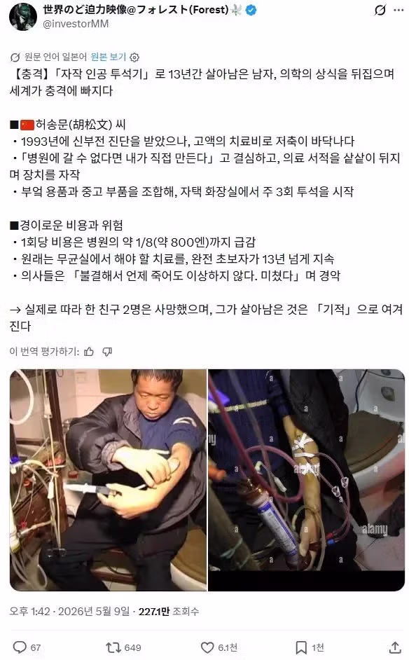 중국 민간인의 의료 기술.jpg - 더쿠 인기글 이미지 1 - 밈카세