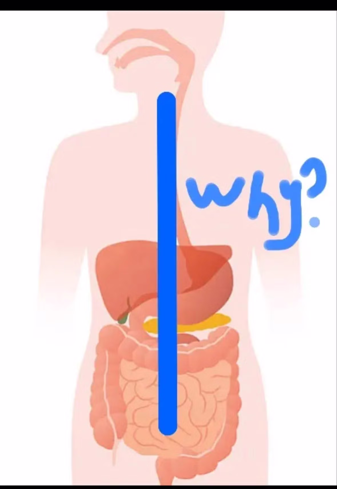 외국에서 유행했던 why 밈 ㅋㅋㅋㅋㅋ - 뽐뿌 인기글 이미지 8 - 밈카세