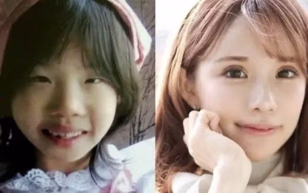 성형으로 2억2천만원 쓴 일본 인플루언서 - SLR클럽 인기글 이미지 1 - 밈카세