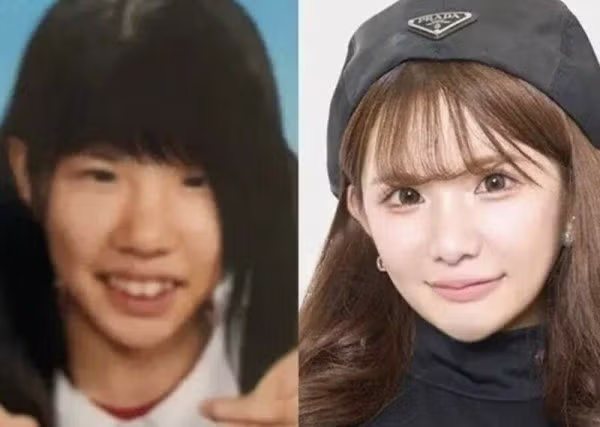 성형으로 2억2천만원 쓴 일본 인플루언서 - SLR클럽 인기글 이미지 2 - 밈카세