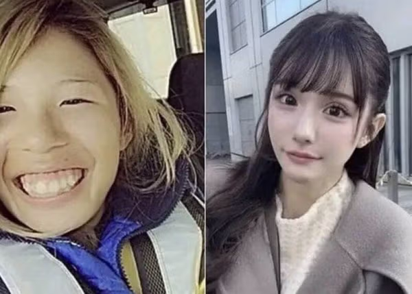 성형으로 2억2천만원 쓴 일본 인플루언서 - SLR클럽 인기글 이미지 3 - 밈카세