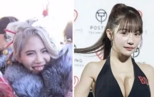 성형으로 2억2천만원 쓴 일본 인플루언서 - SLR클럽 인기글 이미지 5 - 밈카세