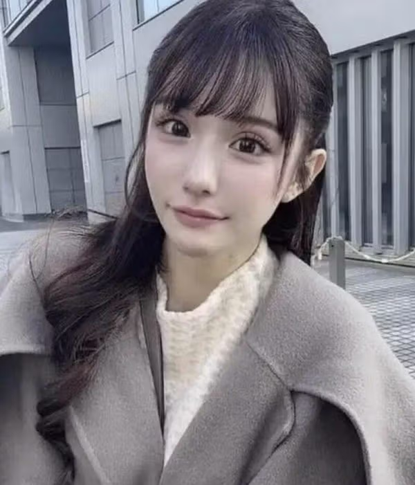 성형으로 2억2천만원 쓴 일본 인플루언서 - SLR클럽 인기글 이미지 6 - 밈카세