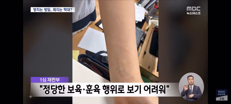 말리다가 생긴 멍이 아동학대로 인정된 사례와 교육계 반응 - 클리앙 인기글 이미지 9 - 밈카세