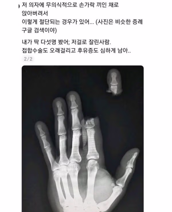 곱창집 방문 시 주의해야 할 돌발 상황 - 뽐뿌 인기글 이미지 3 - 밈카세