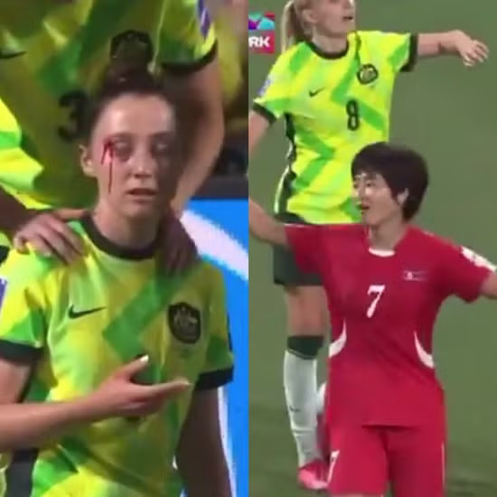 북한 여자축구선수들을 향한 비판적 시각과 그 이유 - FM코리아 인기글 이미지 5 - 밈카세