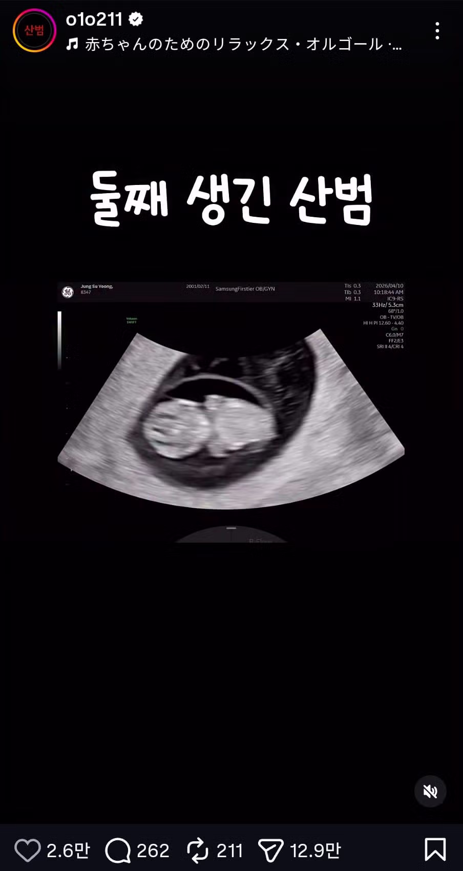 공혁준의 최근 근황 - FM코리아 인기글 이미지 1 - 밈카세