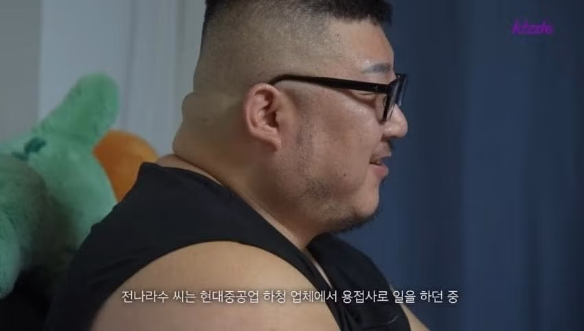 조선소 사고로 다리를 잃은 청년의 사연 - 인벤 인기글 이미지 3 - 밈카세