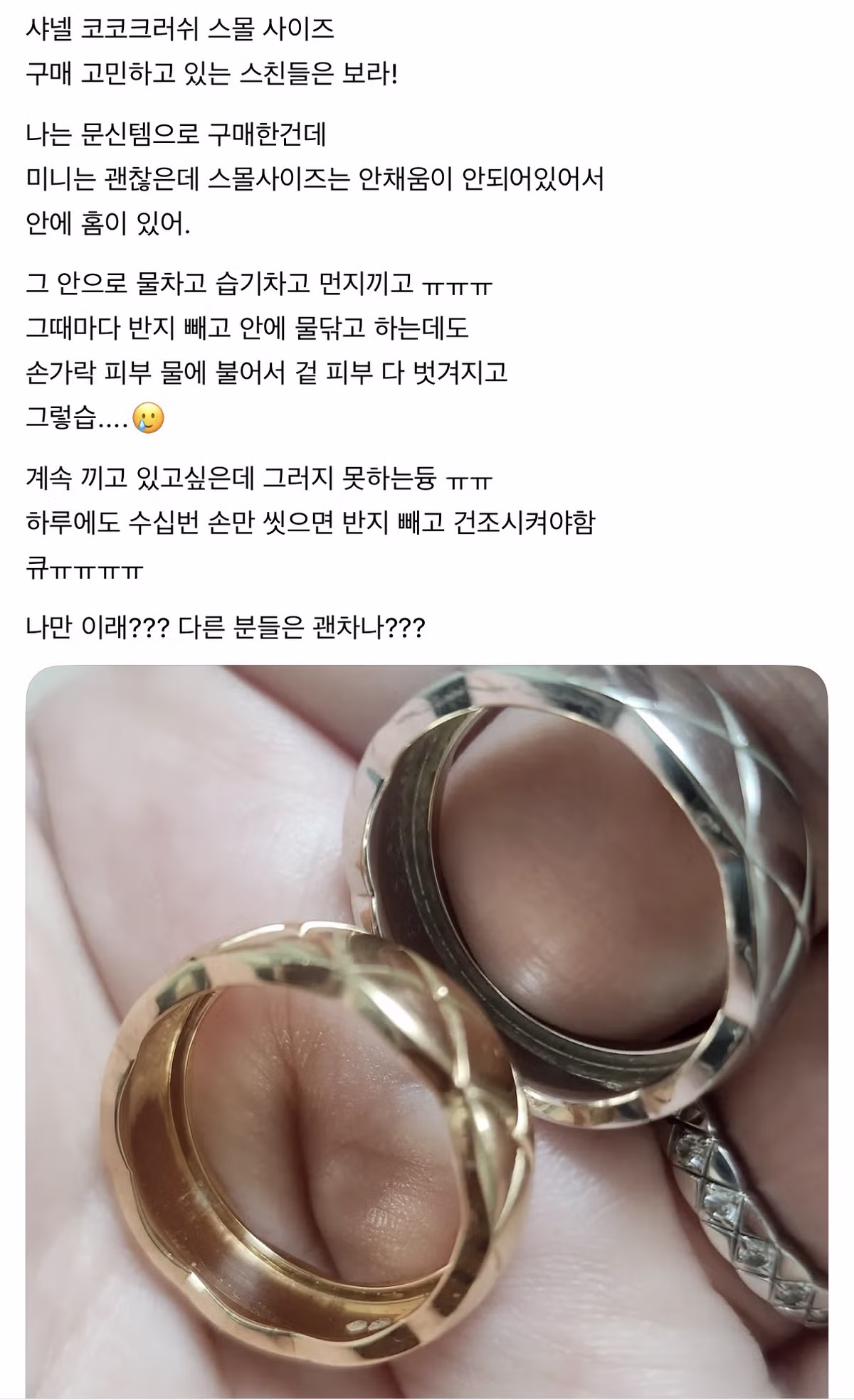 샤넬 반지 끼고 습진 생긴 사람들.thread 3