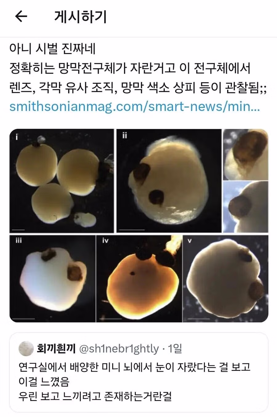 간이식과 심장이식은 있어도 눈이식은 없는 이유 - 더쿠 인기글 이미지 3 - 밈카세