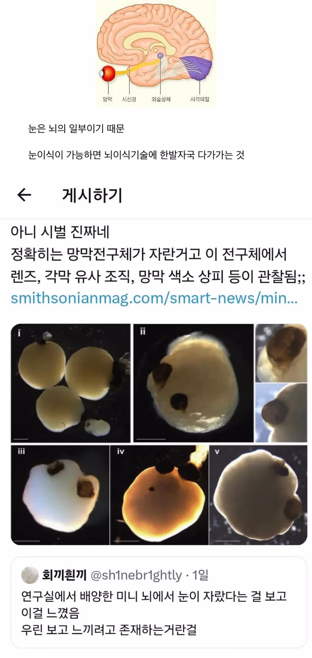 간이식 심장이식은 있지만 눈이식은 없는 이유 - 뽐뿌 인기글 이미지 1 - 밈카세