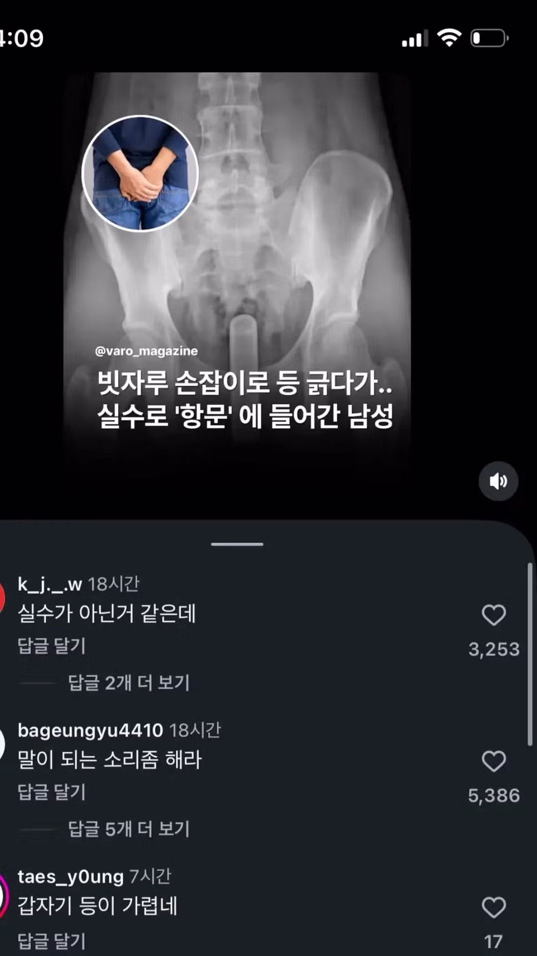 함부로 등을 긁어주면 안 되는 이유 - 더쿠 인기글 이미지 1 - 밈카세