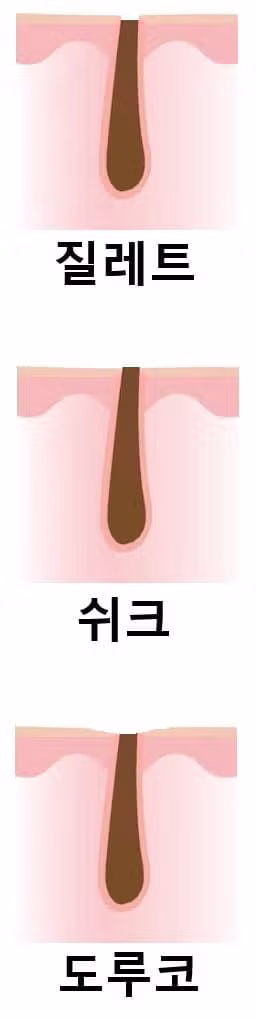 면도날 3대장 제품별 면도 후 느낌 비교 - 인벤 인기글 이미지 1 - 밈카세