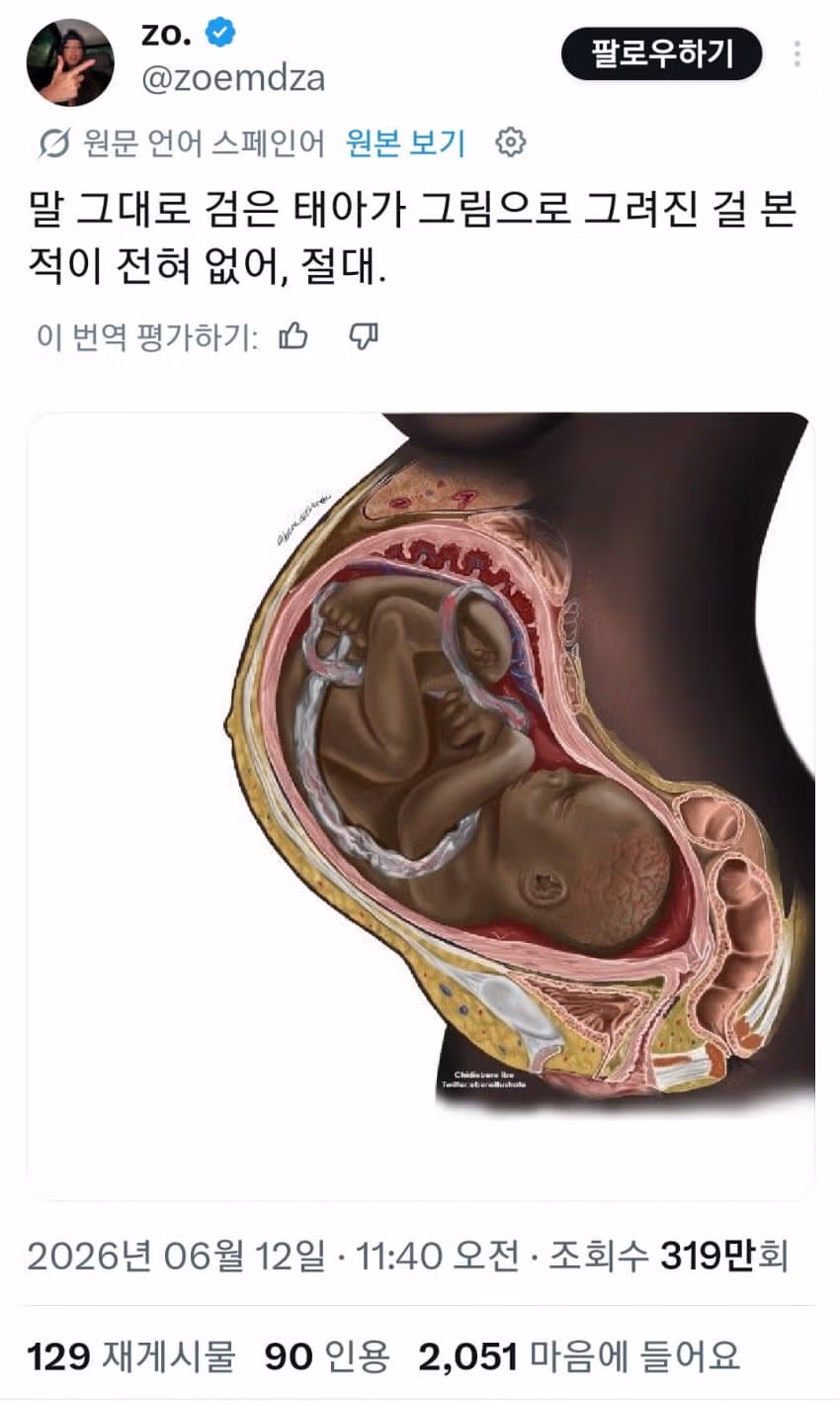 검은 태아를 본 적 없다는 주장의 황당함 - FM코리아 인기글 이미지 1 - 밈카세