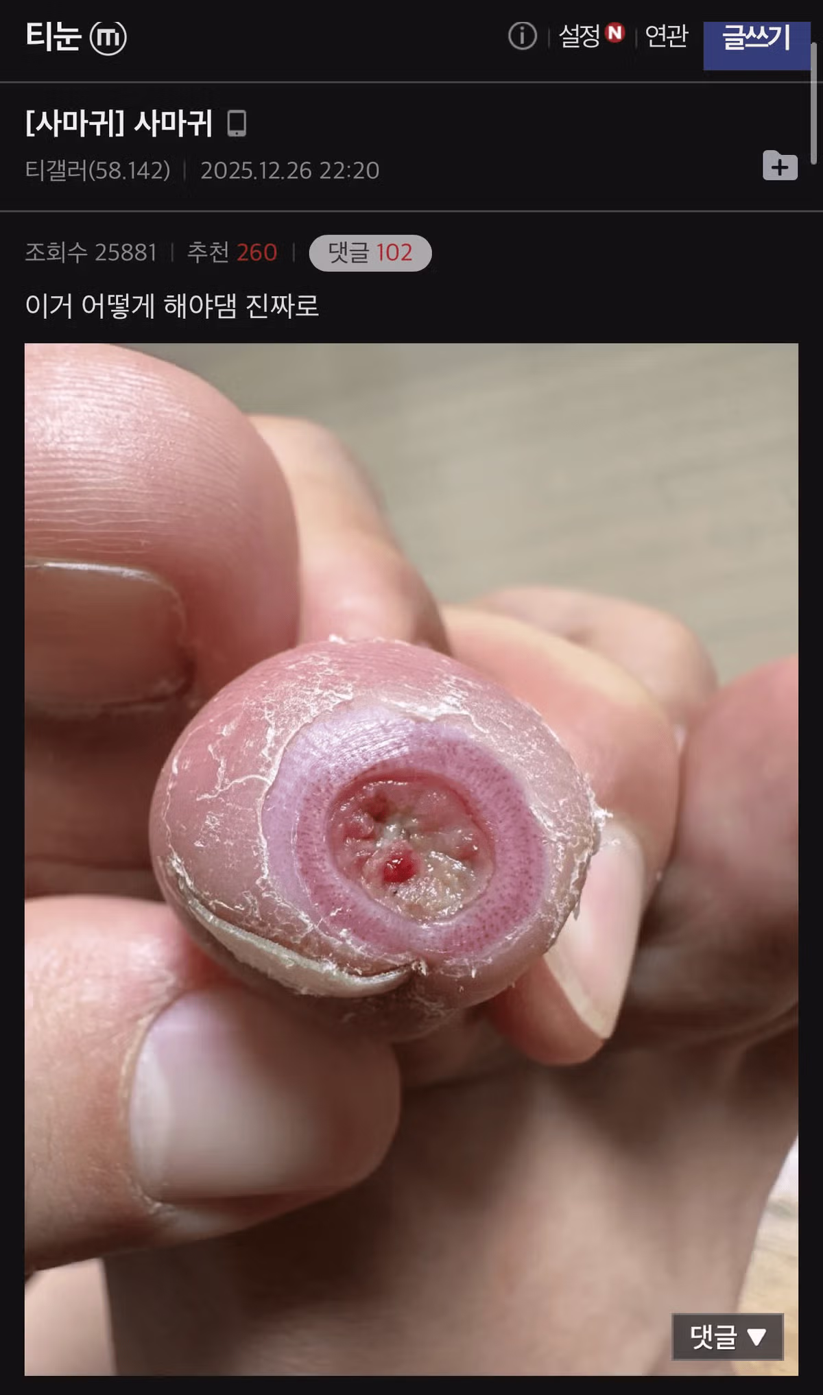 티눈 갤러리 칠성장어 친구의 충격적인 근황 - FM코리아 인기글 이미지 1 - 밈카세