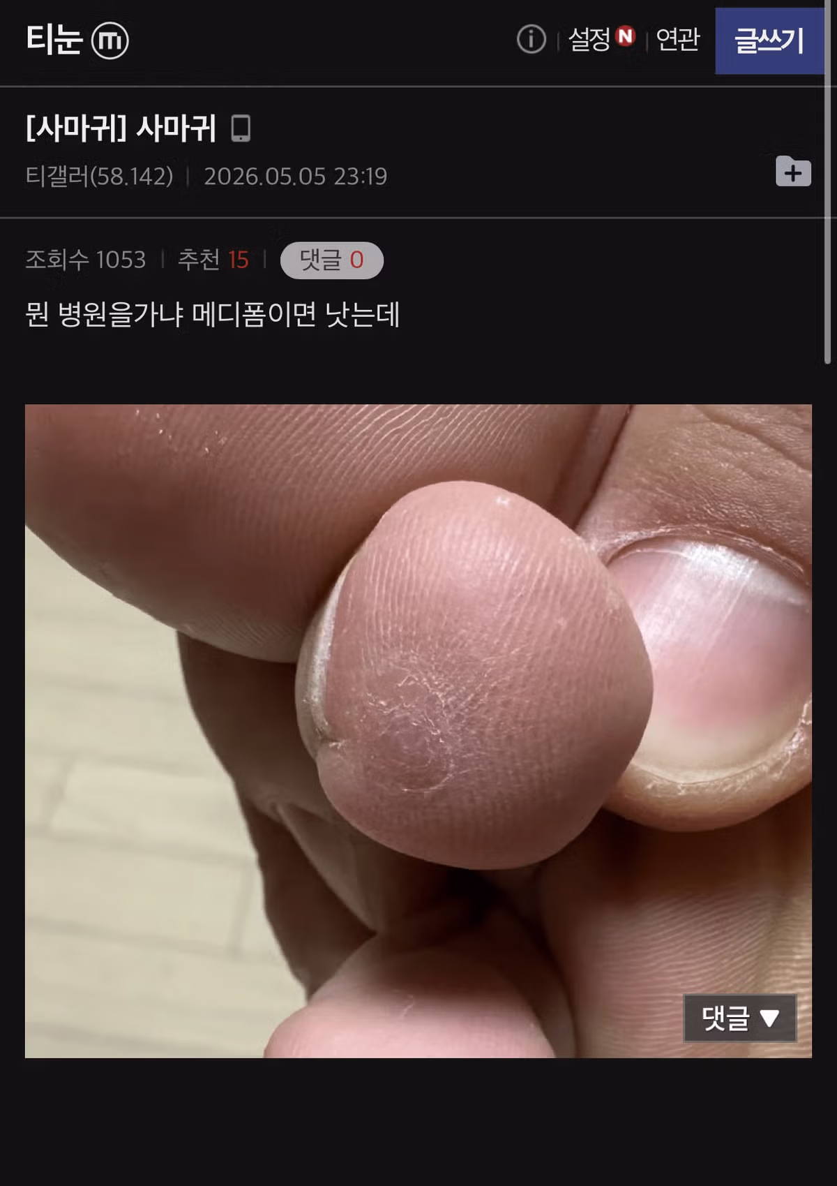 티눈 갤러리 칠성장어 친구의 충격적인 근황 - FM코리아 인기글 이미지 3 - 밈카세