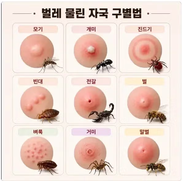 벌레 물린 자국 구별하는 방법 - 뽐뿌 인기글 이미지 1 - 밈카세