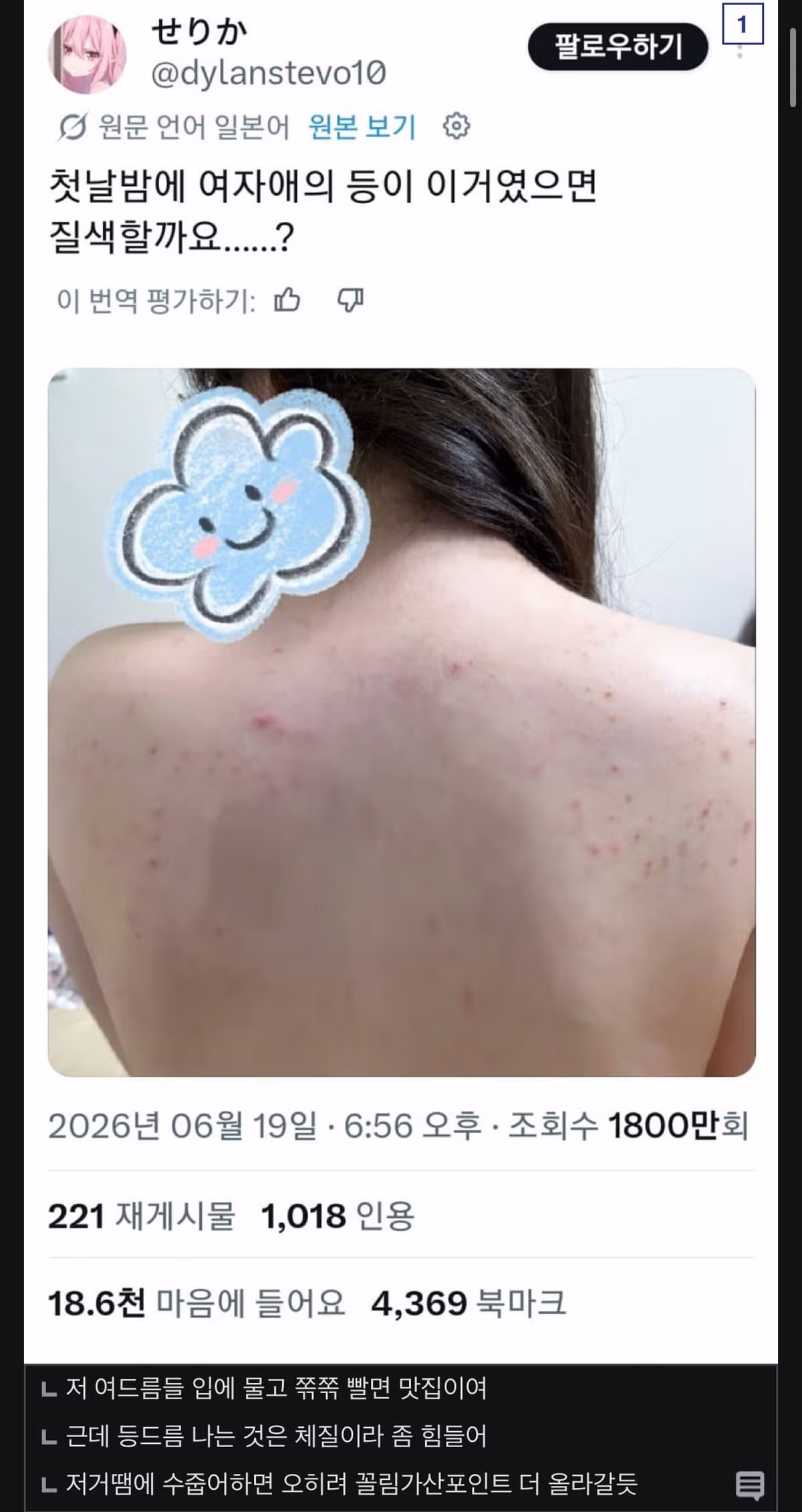 첫날밤에 여자 등이 이러면 싫어할까요 - 인벤 인기글 이미지 1 - 밈카세