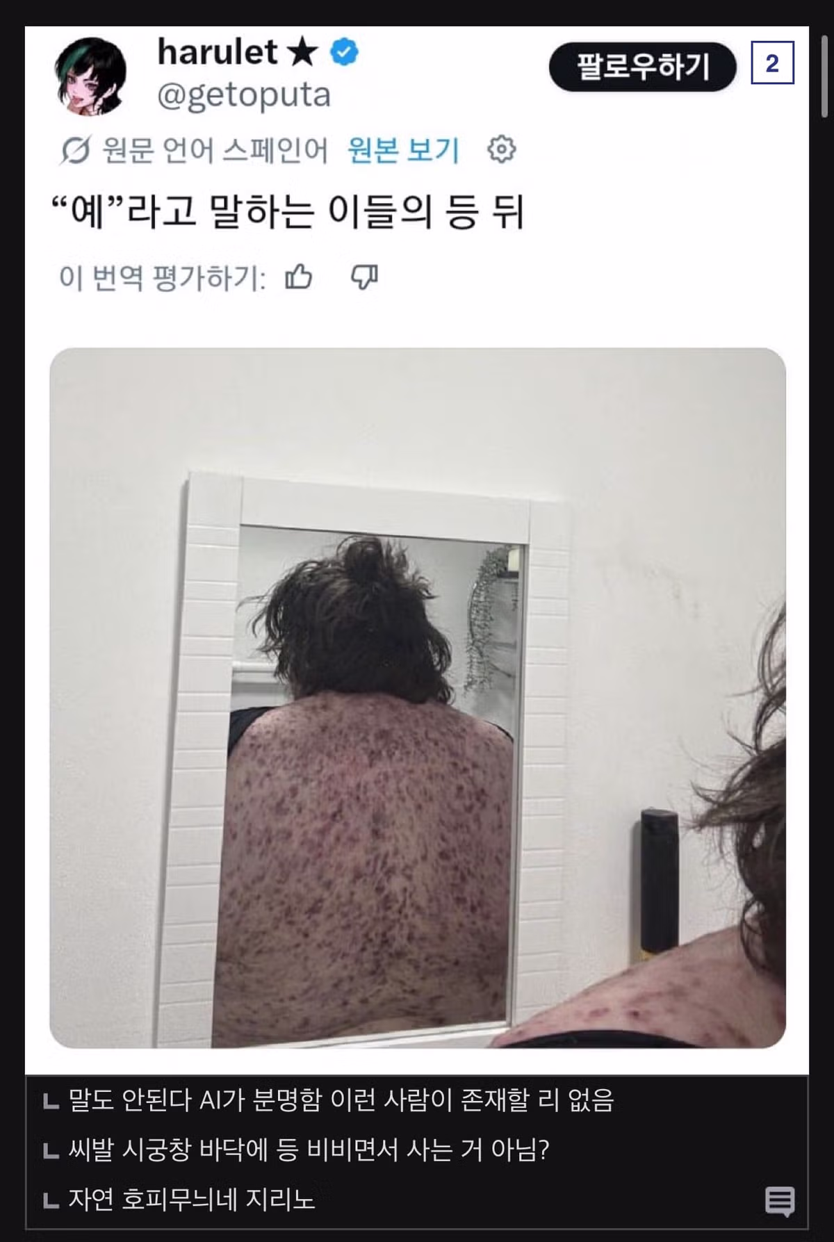 첫날밤에 여자 등이 이러면 싫어할까요 - 인벤 인기글 이미지 2 - 밈카세