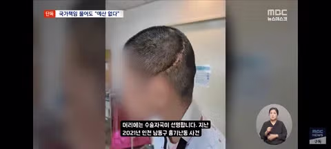 5년 싸움 끝 국가 책임 인정했는데‥'당장 줄 돈 없다' - 클리앙 인기글 이미지 3 - 밈카세