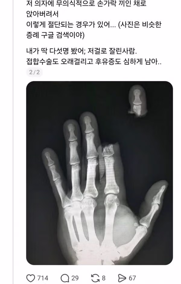 고깃집에서 빈번하게 발생하는 손가락 절단 사고 - 인벤 인기글 이미지 3 - 밈카세