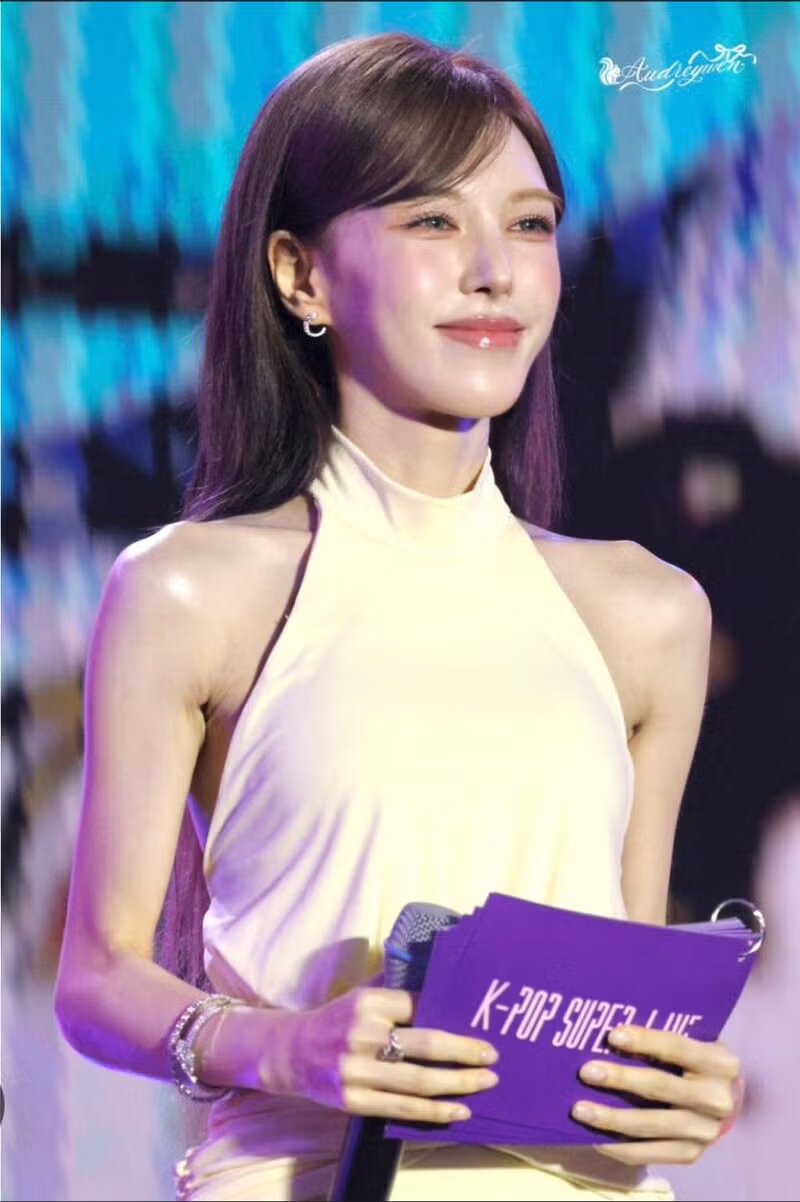 레드벨벳 웬디의 마른 몸매에 우려하는 팬들 - 클리앙 인기글 이미지 4 - 밈카세