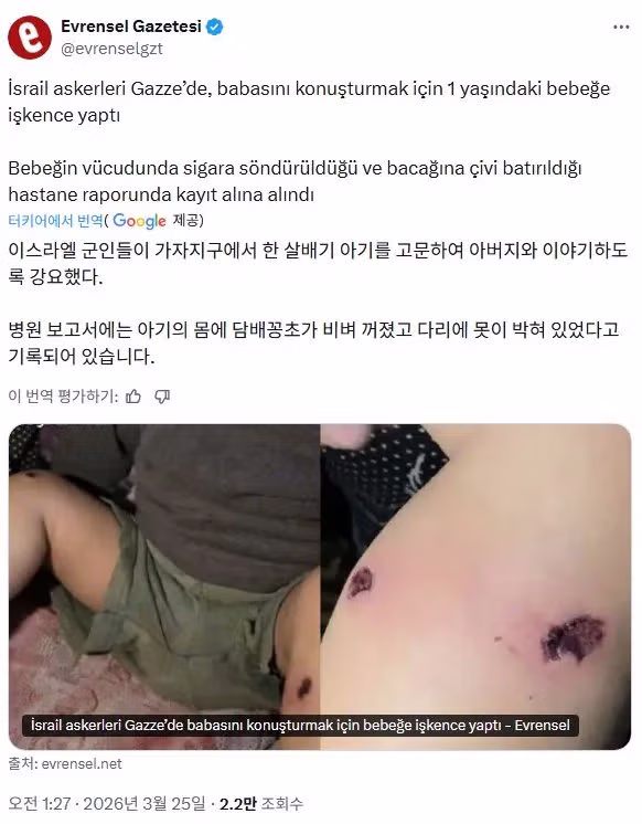 약혐) 아버지의 자백을 받기 위해 18개월 아기를 담뱃불로 지졌다는 이스라엘군 2