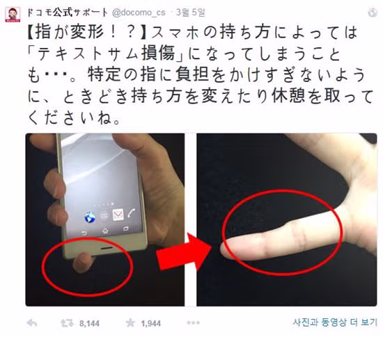 핸드폰 때문에 새끼손가락 변형 온 사람들의 모임.jpg 2