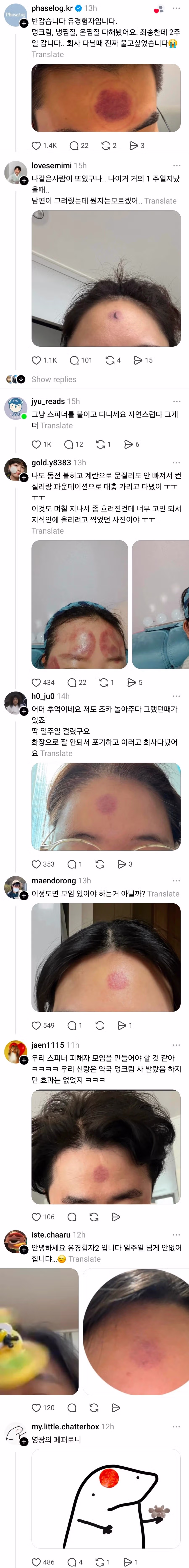 피해자가 속출하고있는 제품 근황 2