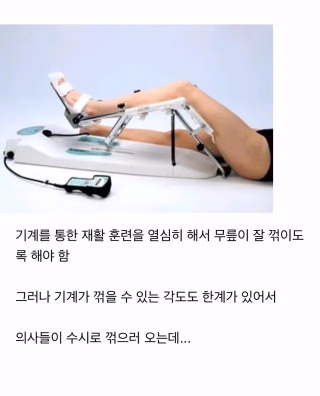 인공 관절 수술 후 환자들이 느끼는 최고의 고통 2