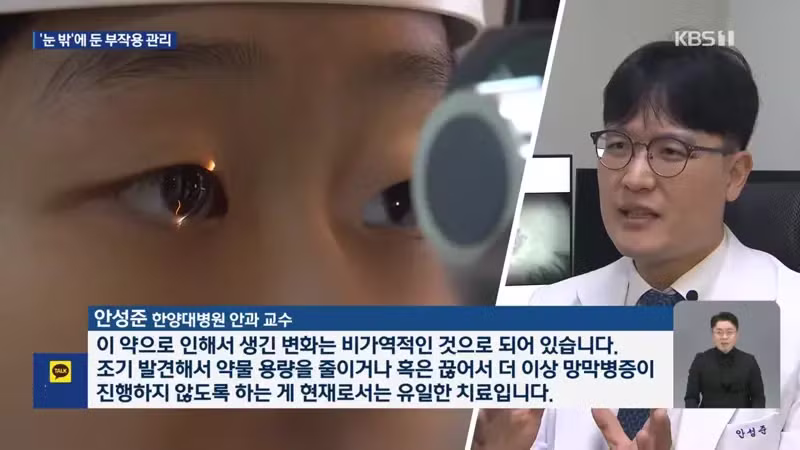 kbs) 류마티스 약 먹다 시력 손상..."검사 필수" - 디시인사이드 인기글 이미지 7 - 밈카세